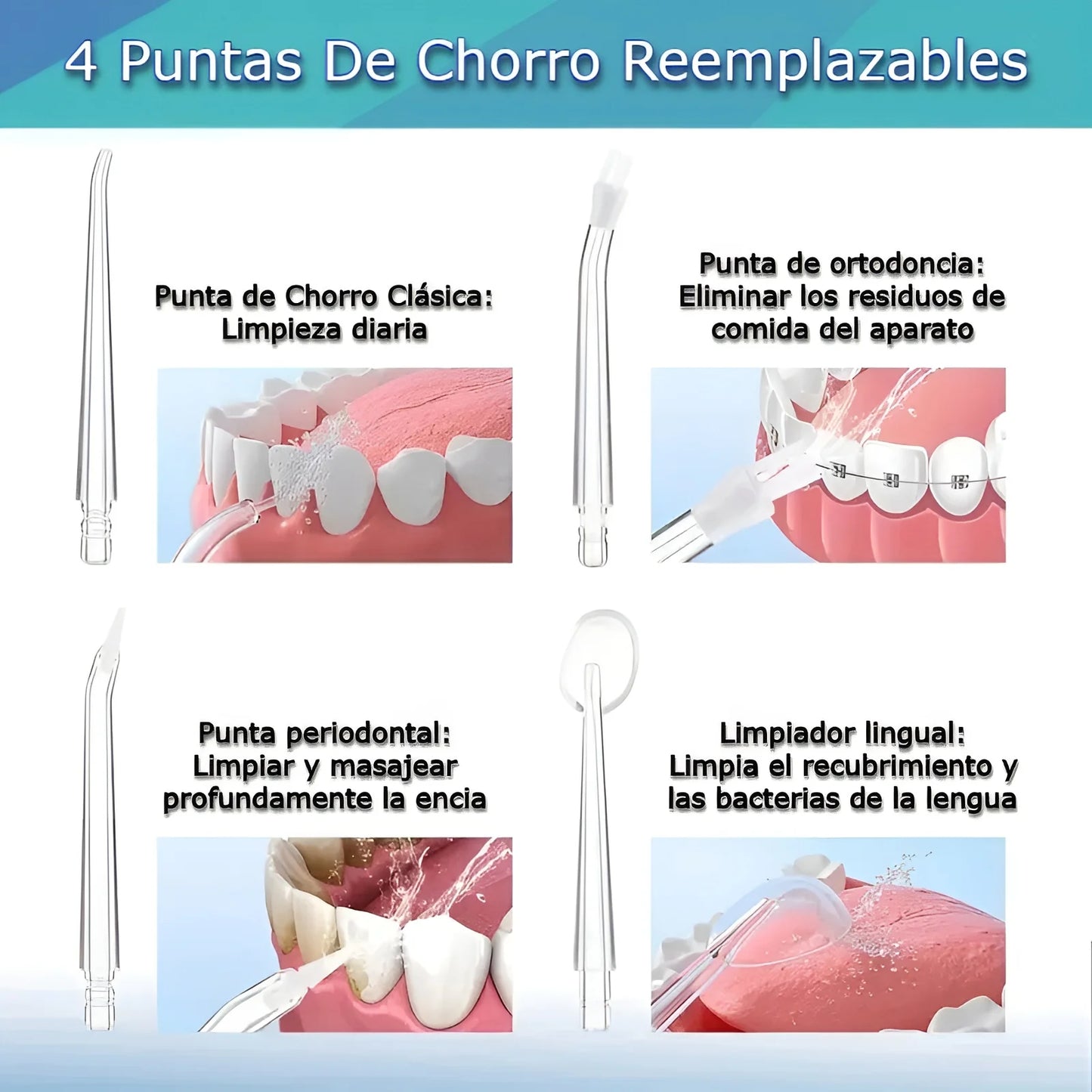 Irrigador Bucal Dental Eléctrico, 4 Boquillas, Limpieza Profunda, Ortodoncia, Encías Sensibles